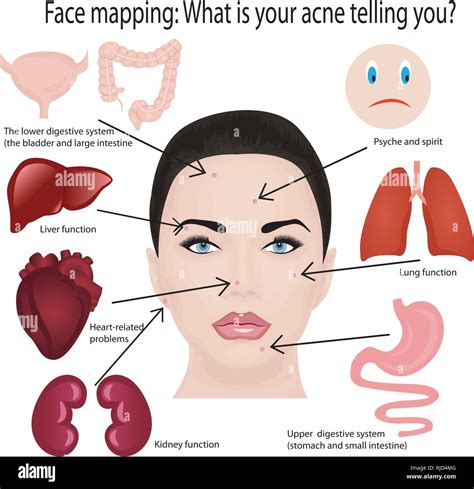 Face Mapping What Your Acne Telling You Info Graphic Showing What