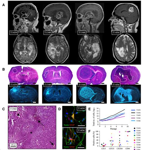 Characterization Of Patient Derived Gscs Magnetic Resonance Imaging Of
