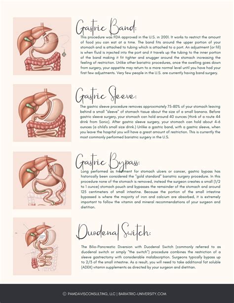 Bariatric Surgery Options