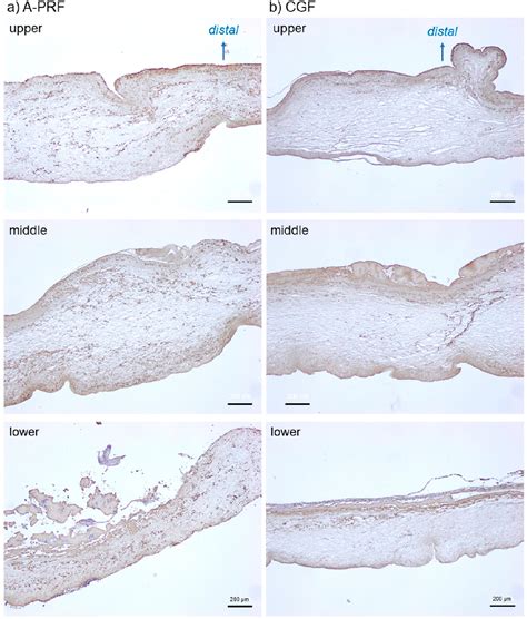 Figure From Quantitative Near Infrared Imaging Of Platelets In