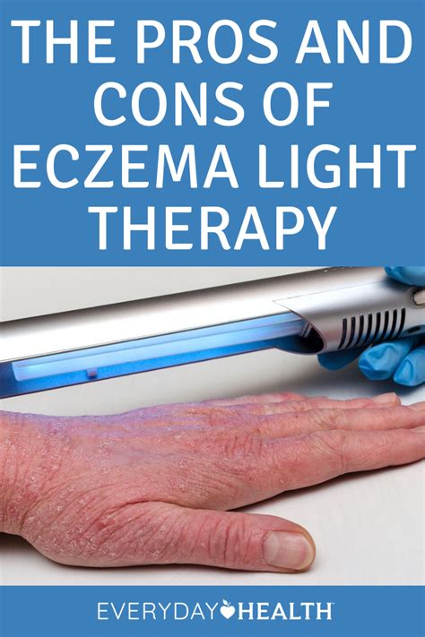 The Pros And Cons Of Eczema Light Therapy Everyday Health In 2021