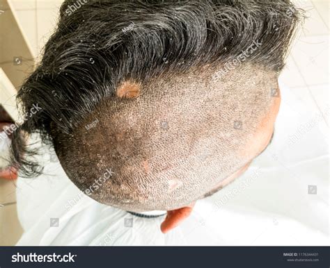 Half Shaved Head Young Man Having Stock Photo 1176344431 Shutterstock