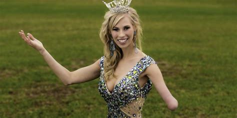 Meet Miss Iowa The Beauty Queen Without A Left Forearm Raising Awareness For Disability