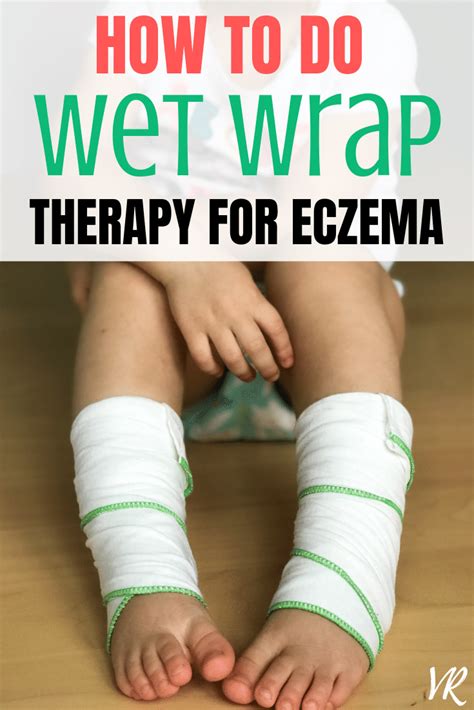 How To Do Wet Wrap Therapy For Eczema Relief Eczema Relief Eczema