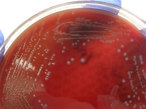 Enterococcus Faecalis Microbiology Microbiology Lab Medical