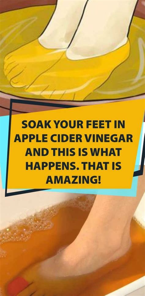 Soak Your Feet In Apple Cider Vinegar And This Is What Happensthat Is