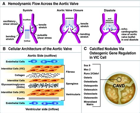 Calcific Aortic Valve Disease Not Simply A Degenerative Process Circulation