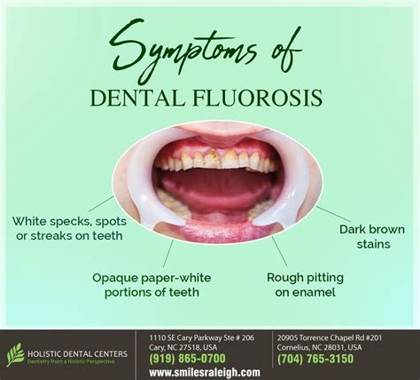 Symptoms Of Dental Fluorosis Holistic Dentistry Dental Fluorosis