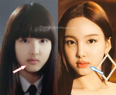 Nayeon Before And After 2022