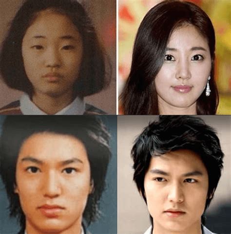 Korean Actress Nose Job Before And After Guwqru