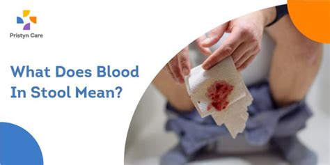 What Does Blood In Stool Mean Pristyn Care