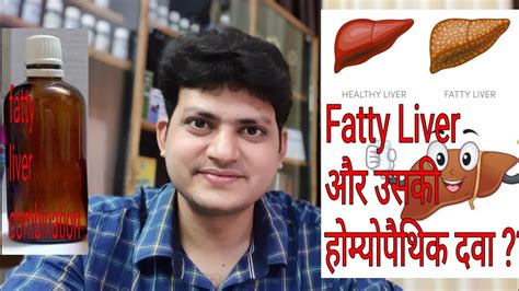Fatty Liver Homeopathic Medicine For Fatty Liver My Combination