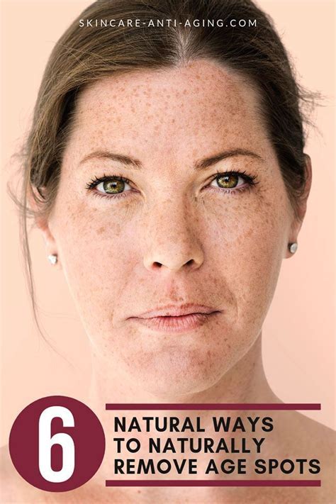 Six Natural Methods You Can Naturally Remove Age Spots On Face And