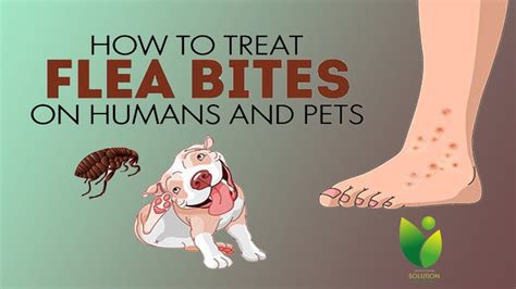 how do you get rid of fleas on a human