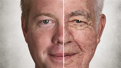 Seniors Health As Related To Aging Skin Pictures