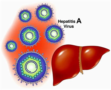 Hepatitis A información y prevención de la enfermedad Fitness