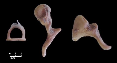 The Three Auditory Ossicles From Left To Right The Stapes Malleus