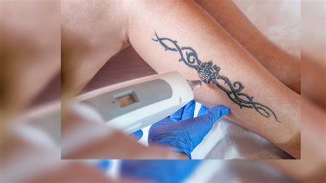 However, laser removal is much less uncomfortable than actually getting tattooed—and significantly faster! Laser Tattoo Removal: Permanent Tattoo Removal - Advance ...