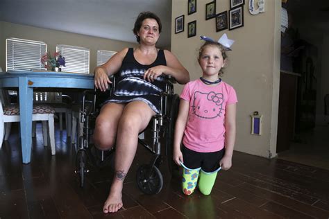 Girl Who Lost Legs Advises New Amputee Her Mom