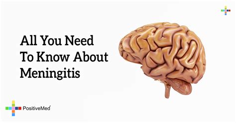All You Need To Know About Meningitis Positivemed