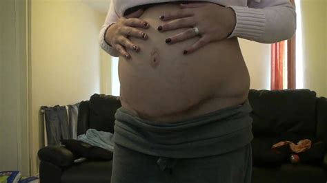 32 Weeks Pregnant After Tummy Tuck Youtube