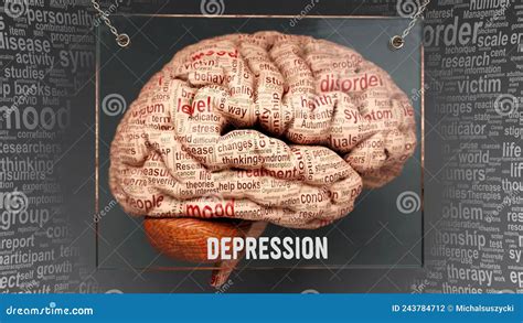 Depression Anatomy Its Causes And Effects Projected On A Human Brain