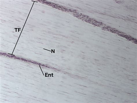 Tendon Dense Regular Connective Tissue 10x Histology