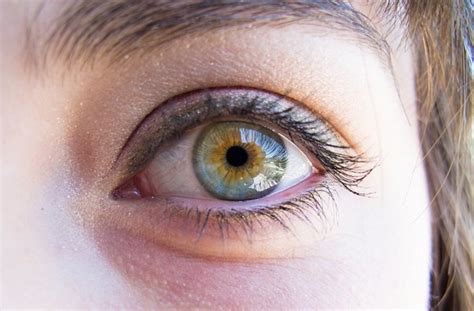 What Is The Difference Between Hazel Eyes And Central Heterochromia