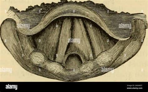 Vocal Cord Diseases Hi Res Stock Photography And Images Alamy