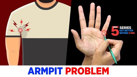 Right Armpit Treatment By Sujok Armpit Infection💪🏻😖 Allergy