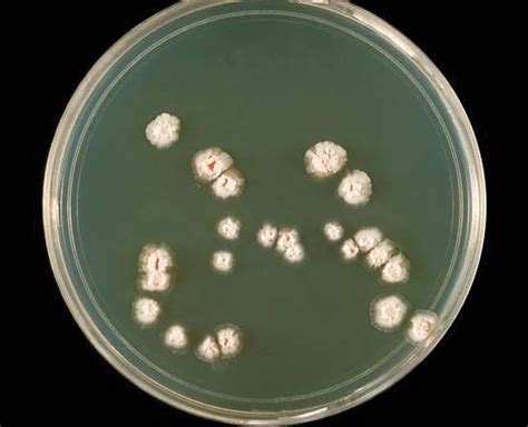 Nocardiosis Pathology