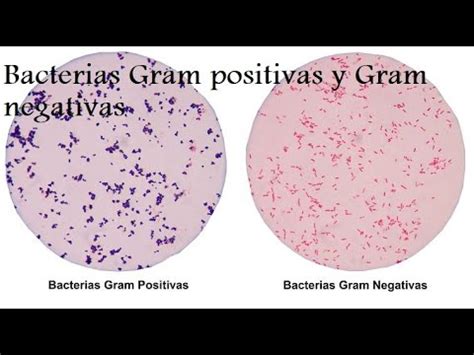De Que Color Se Ti En Las Bacterias Gram Negativas Steam Educaci N