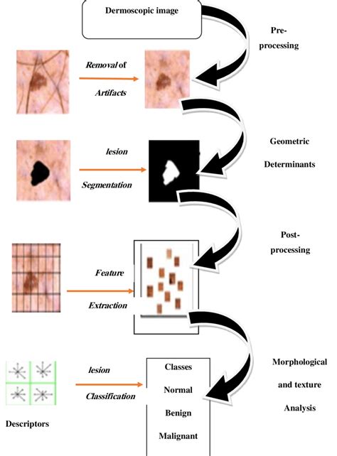the process an early diagnosis skin lesions classification using masits download scientific