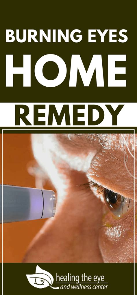 Burning Eyes Home Remedy Natural Remedies Healing The Eye
