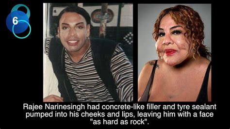 10 Worst Plastic Surgery Disasters Youtube