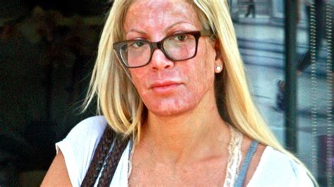 Tori Spelling Leaves Spa With Inflamed Red Face What Happened