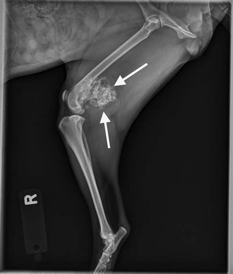 These Radiographs Provide Case Based Examples Of Primary And Metastatic