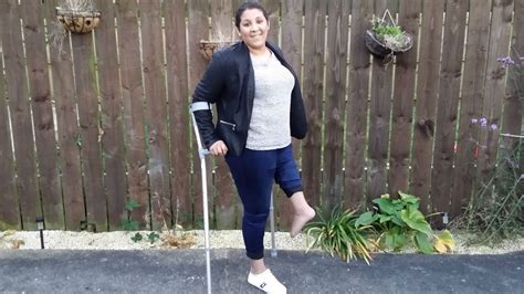 Bbc Radio 5 Live 5 Live In Short Amputee Gets A New Knee Using Her