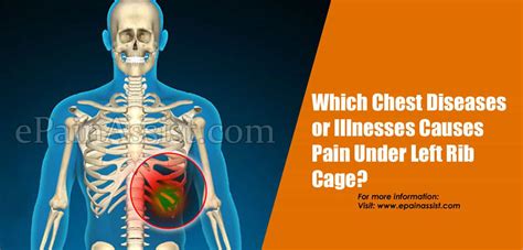 Pain Under Left Rib Worse When Bending Over What Causes Pain Under