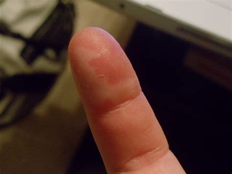 The Grub Tub: Dinner and a burnt finger