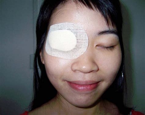 10pcs Sterile Eye Patch Medical Non Woven Eye Patch Eyeshade Eye Pad