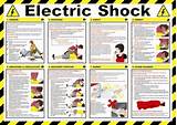 Electric Shock Symptoms