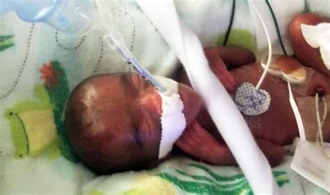 Worlds Tiniest Surviving Baby May 29 2019 The Spokesman Review
