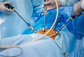 ¿Qué es la laparoscopia? - Dr. Juan Antonio Pedroza