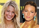 Blake Lively's Nose Job: How She Changed After Plastic Surgery - Celebily