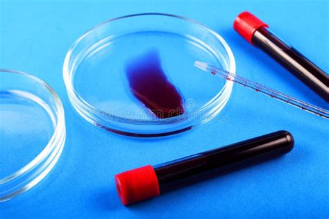 Blood Test With Petri Dish Stock Image Image Of Liquid Blue 181101685