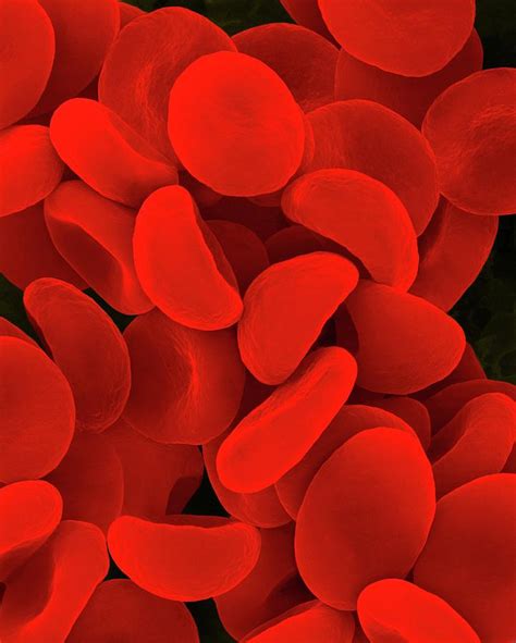 Red Blood Cells In Hypotonic Solution Photograph By Dennis Kunkel