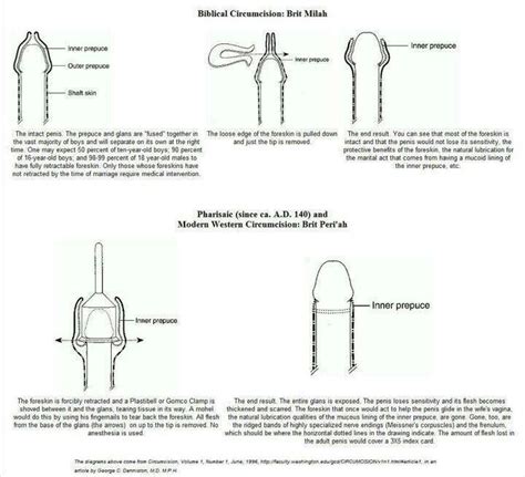 Biblical Circumcision Vs How It Currently Done Circumcision