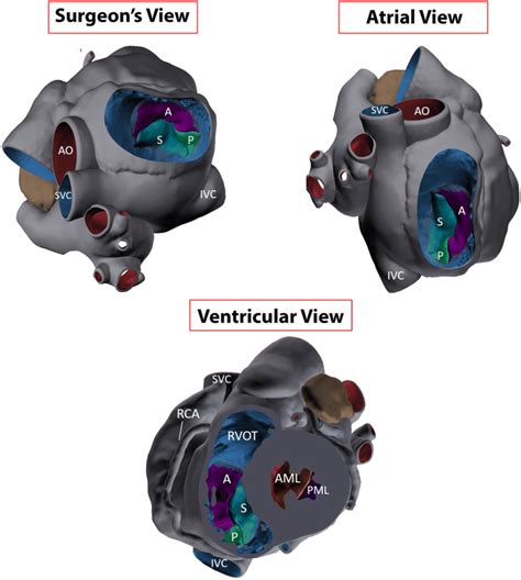 Anatomy Of The Tricuspid Valve Apparatus From Various Views Surgeons
