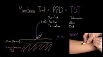 Ppd Test : Signs of a Positive TB Test | Livestrong.com : What does ppd ...